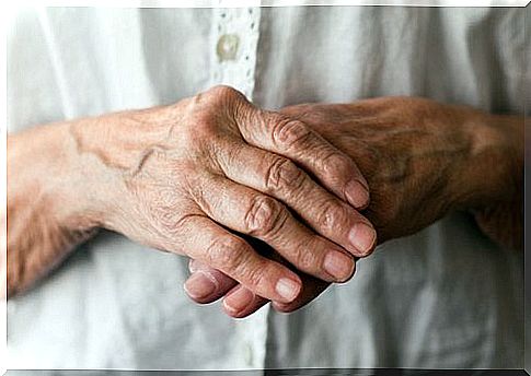 Arthritis in the hands