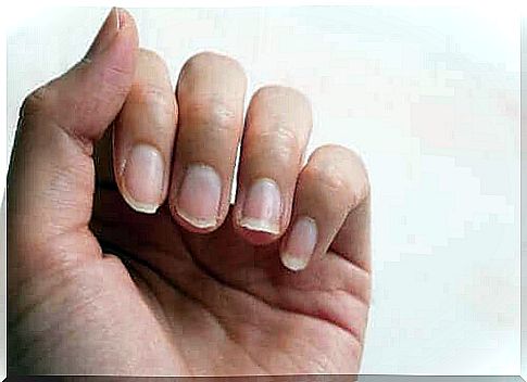 Brittle nails - four natural treatments