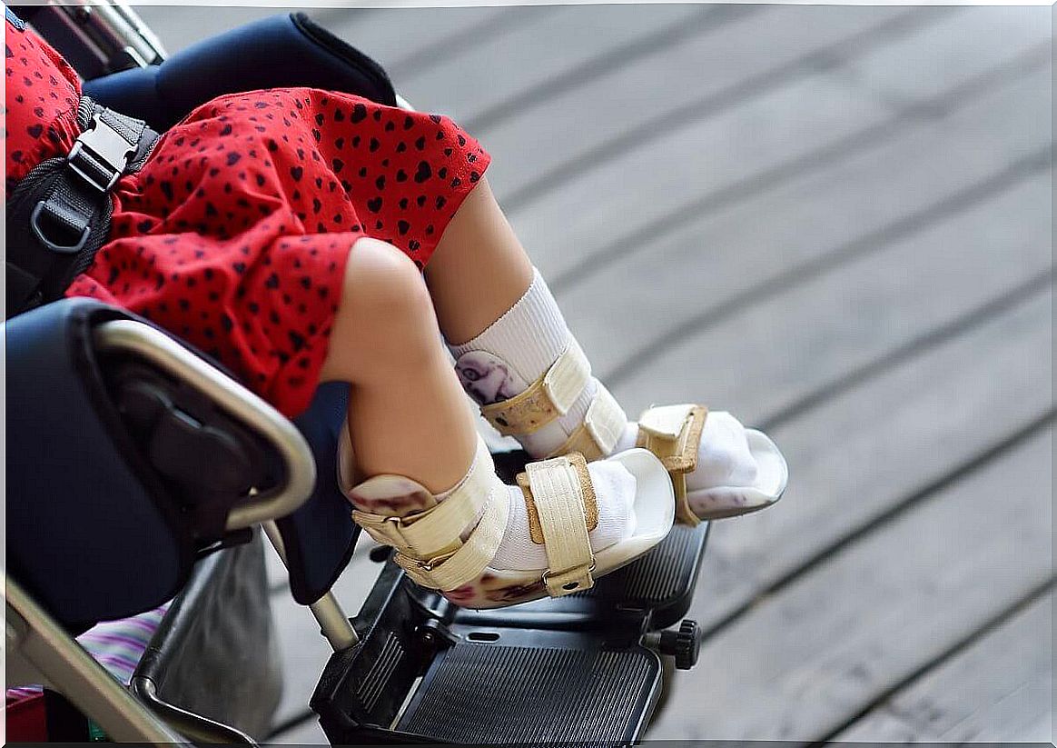 Cerebral palsy occurs due to damage to the brain that leads to impaired motor functions.