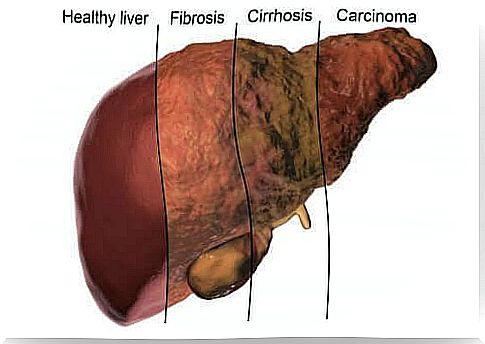 Liver health