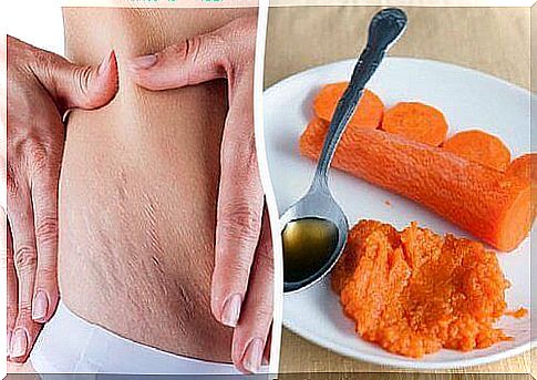 Carrot treatment for stretch marks