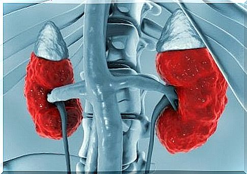 Kidneys - computer diagram