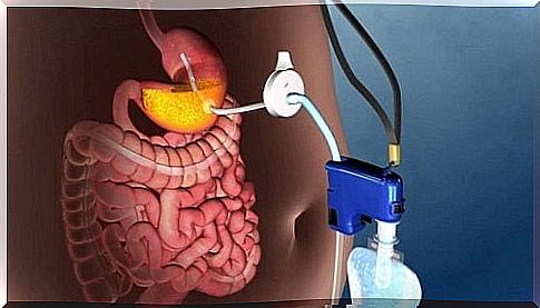 Obesity treated non-surgically - The latest technique