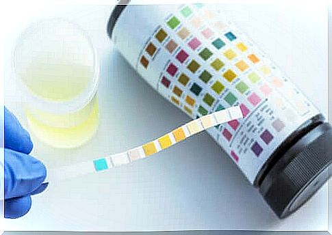 Urine testing: what can it detect?