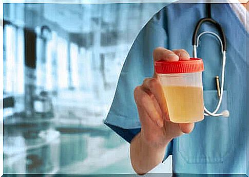 Doctor holding a urine cup